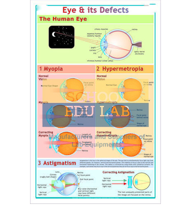 Eye and its Defects Chart