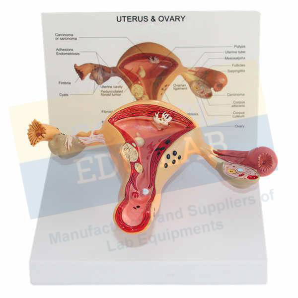 Ovaries Model